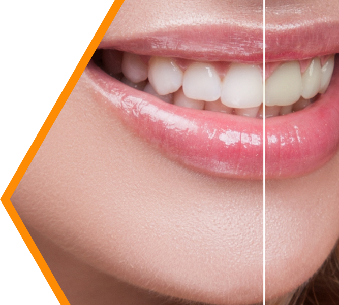 Stunning Smiles of Las Vegas